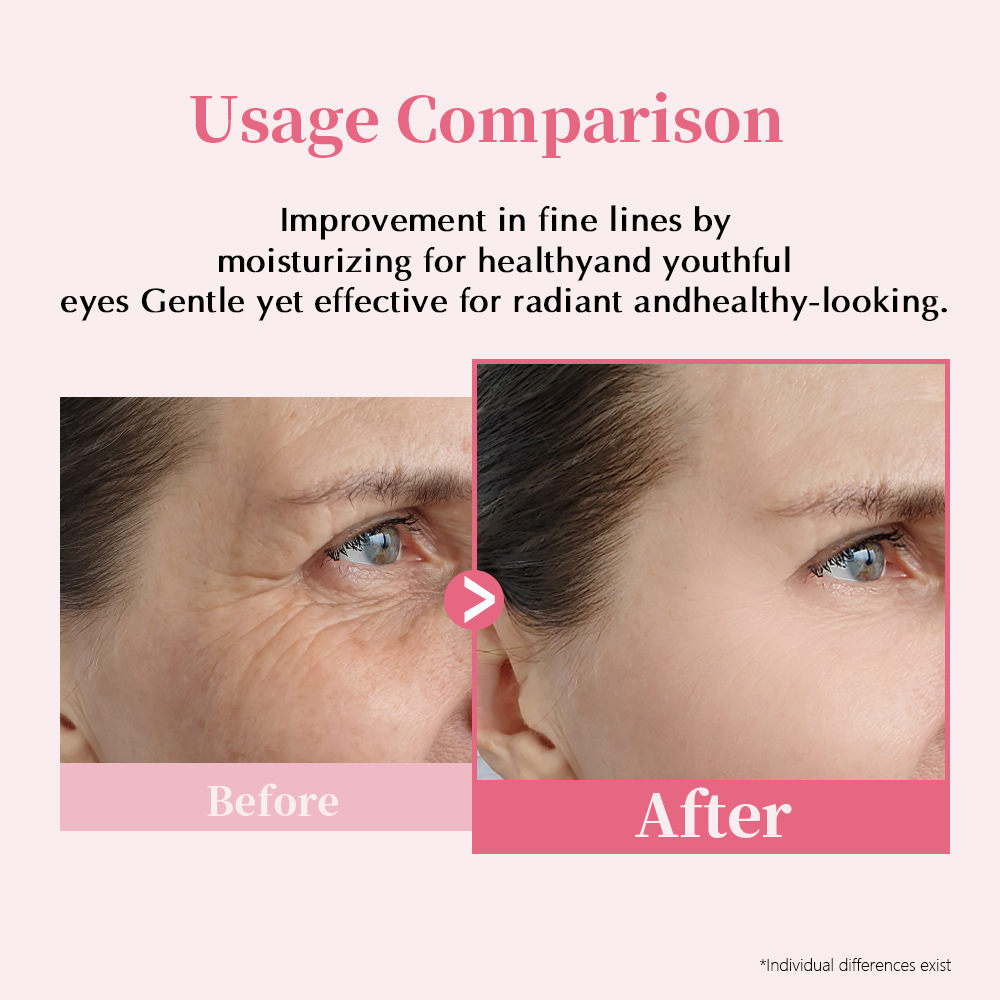 Wholesale PDRN Pink Peptide Eye Serum Anti Aging Eye Cream For Dark Circles Squalane Moisturizing Lifting Firming Private Label