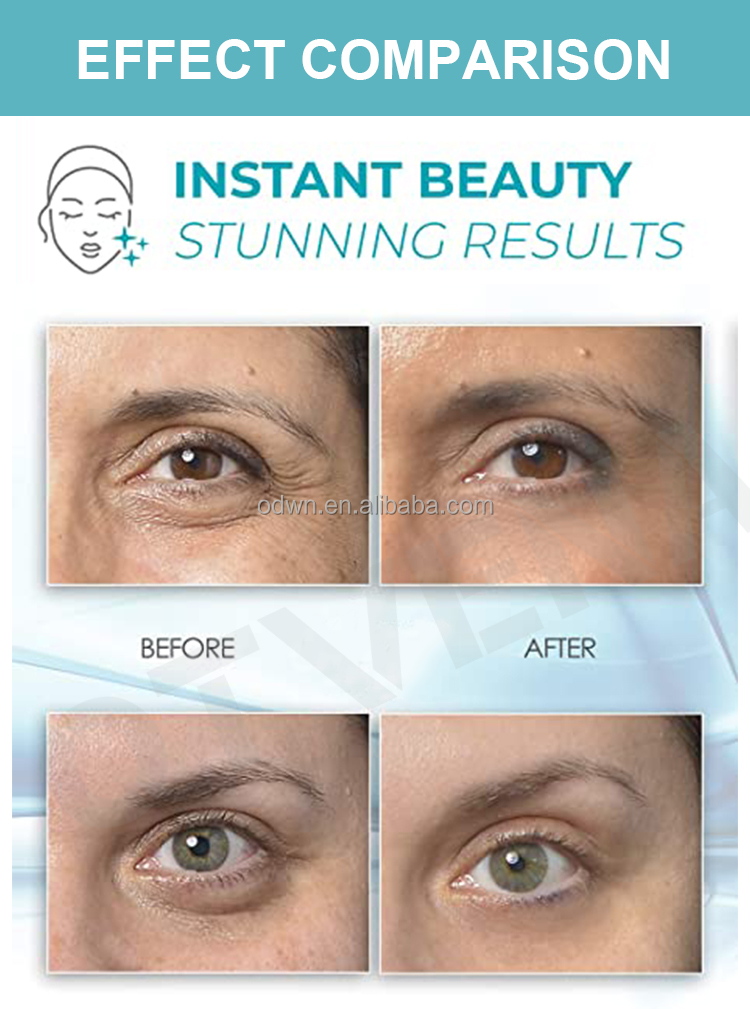 Skin Care Result
