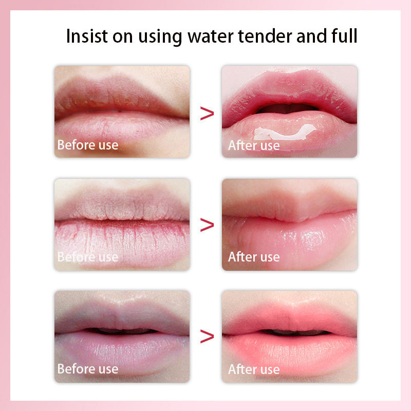 Customizable Lip Mask, Nourishing And Moisturizing Lip Mask, Reduces Lip Lines, Exfoliates And Moisturizes Lip Mask