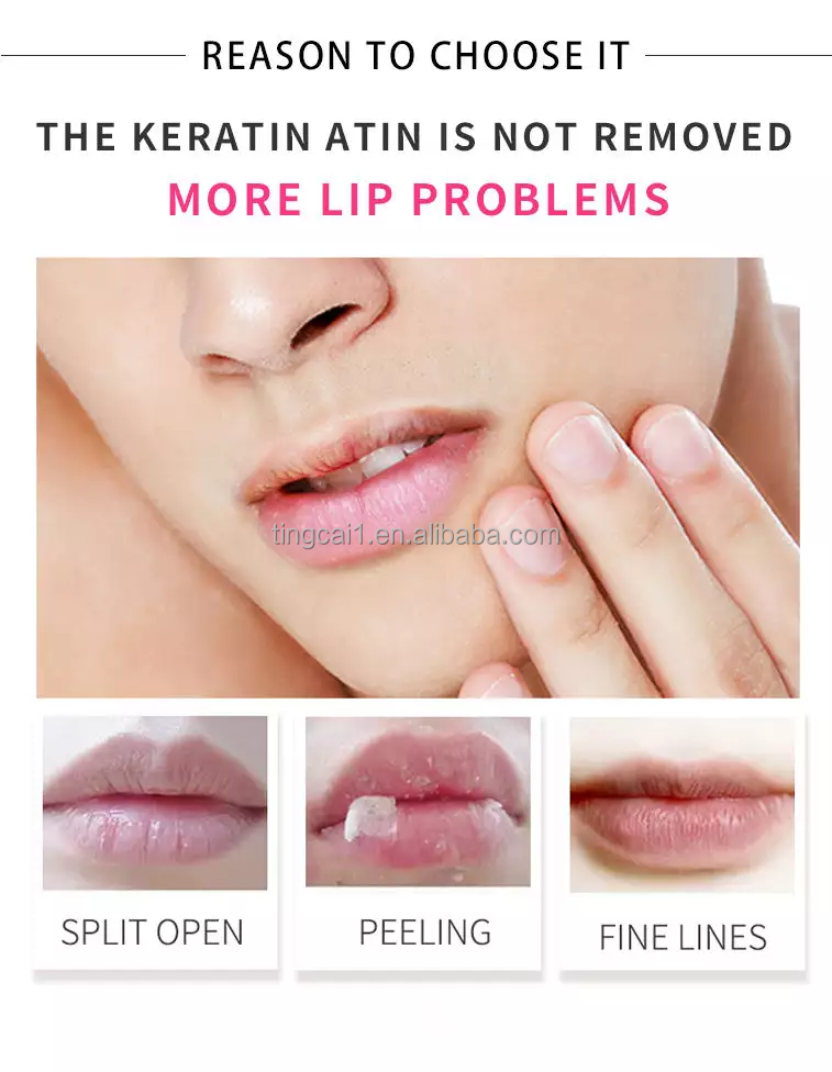 Lip Mask Image 4