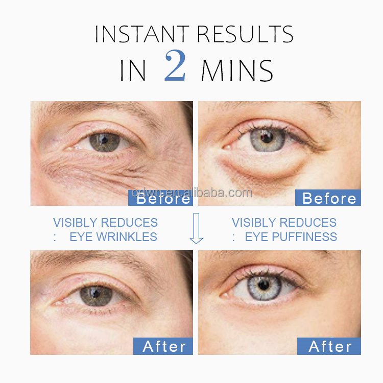 OTVENA Rapid Eye Lift Under Eye Cream For Puffiness And Dark Circles Eye Area Treatment Serum