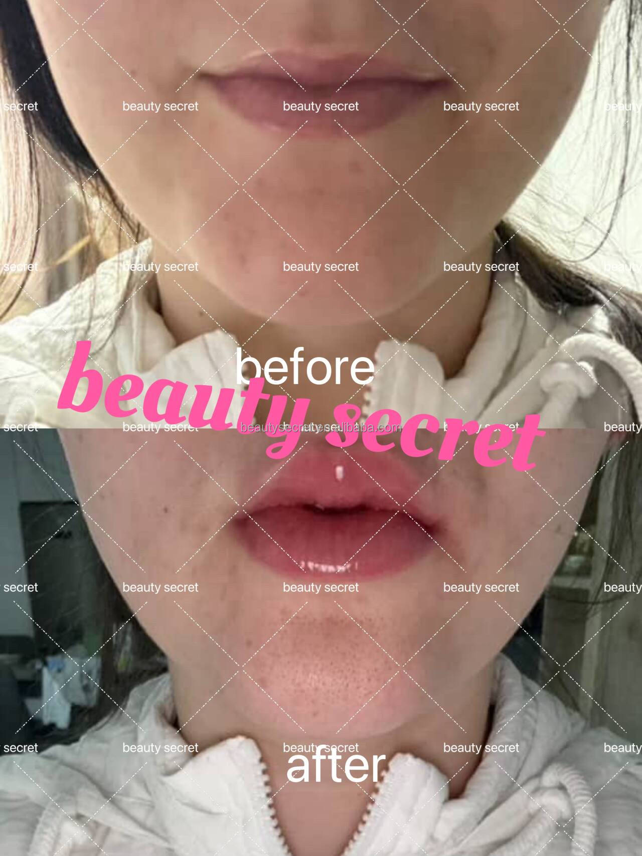 Lip Plumper Gloss Recommend Detail