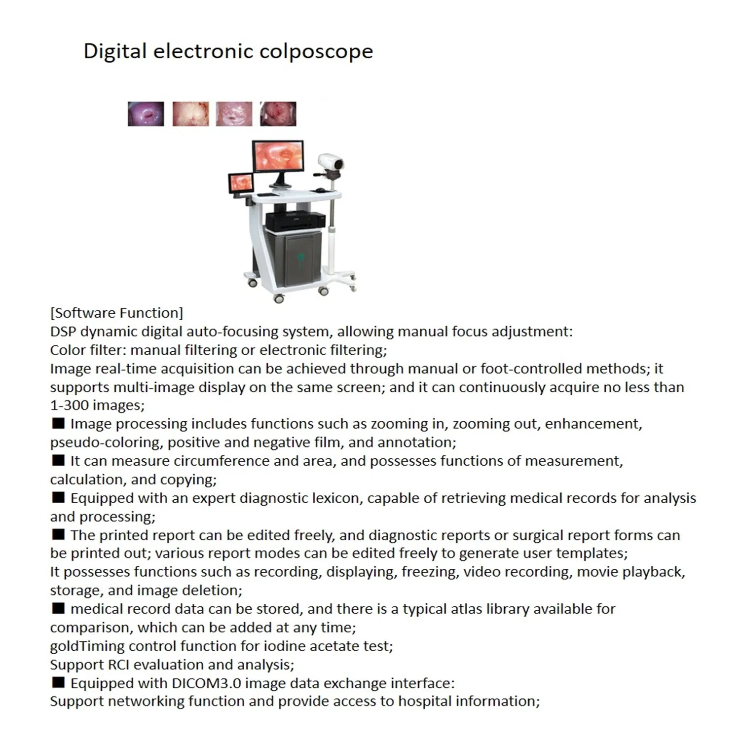 Factory Direct New Digital Digital Electronic Video Colposcop Gynecological Colposcope Medical Endoscopewith Stand Colposcopy