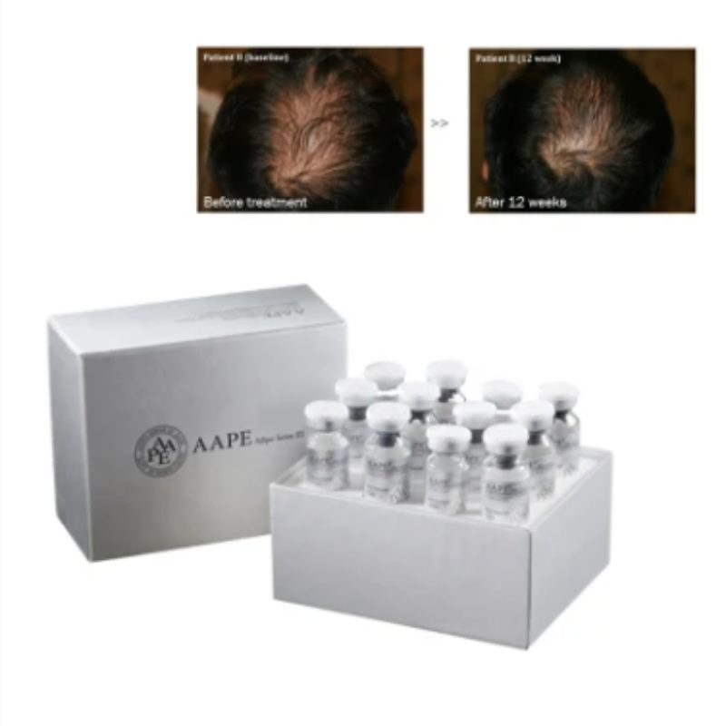 Aape Treatment of Hair Loss and Solve Scalp Problems Care for Hair Growth Treatment of Hair Loss