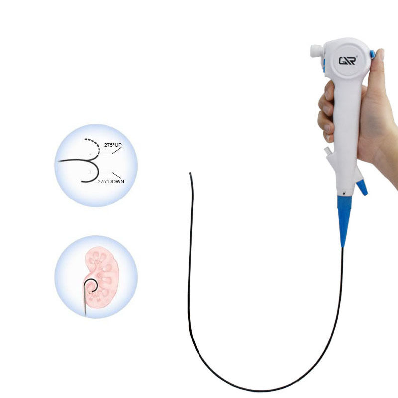 Medical Electric Ureteroscope - Flexible and Disposable Surgical Tool