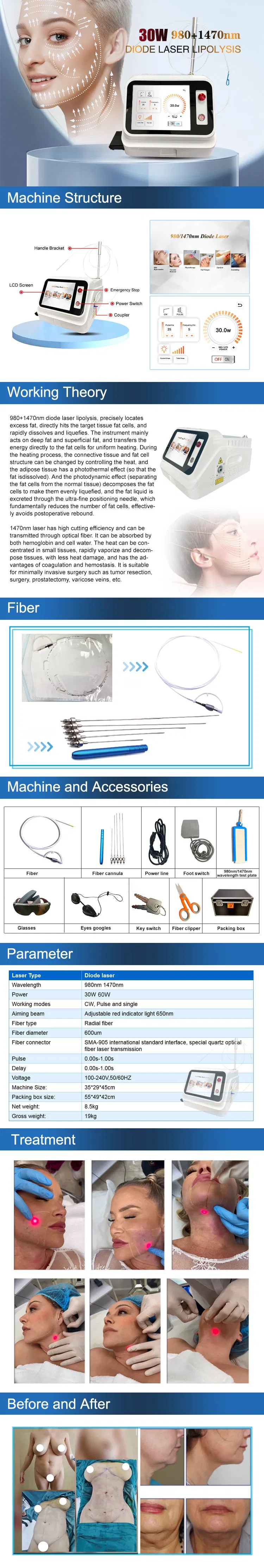 Laser Machine Overview