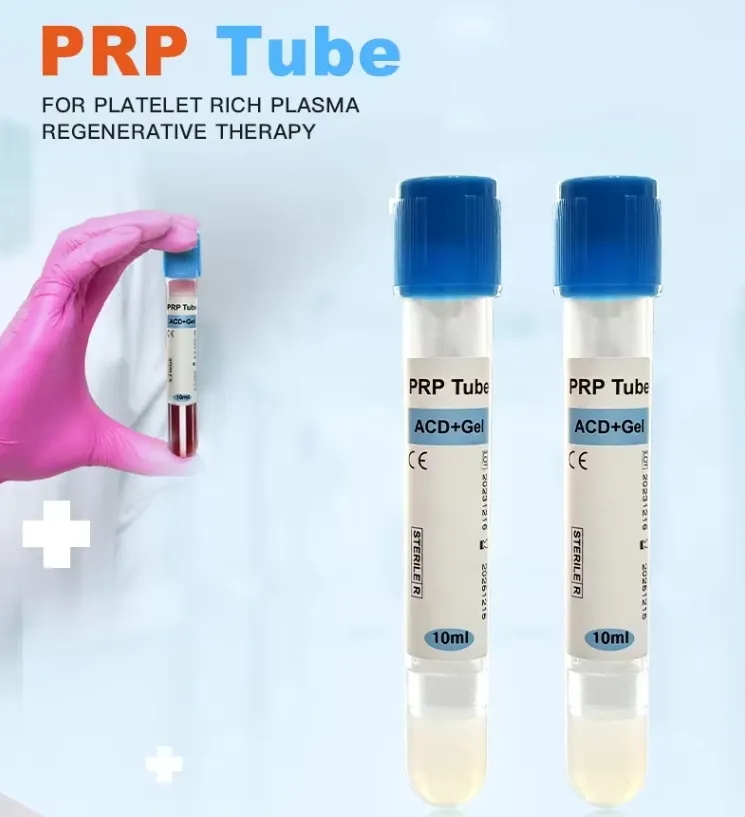PRP Tube Detail 1