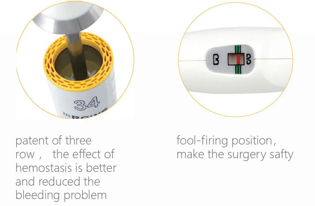 Pph Stapler, Patent 3 Rows Stapler, Laparoscopic Stapler, Disposable, Surgical Stapler, Hemorrhoid and Prolapse Staplers,