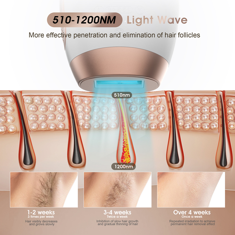 IPL Device Angle 5