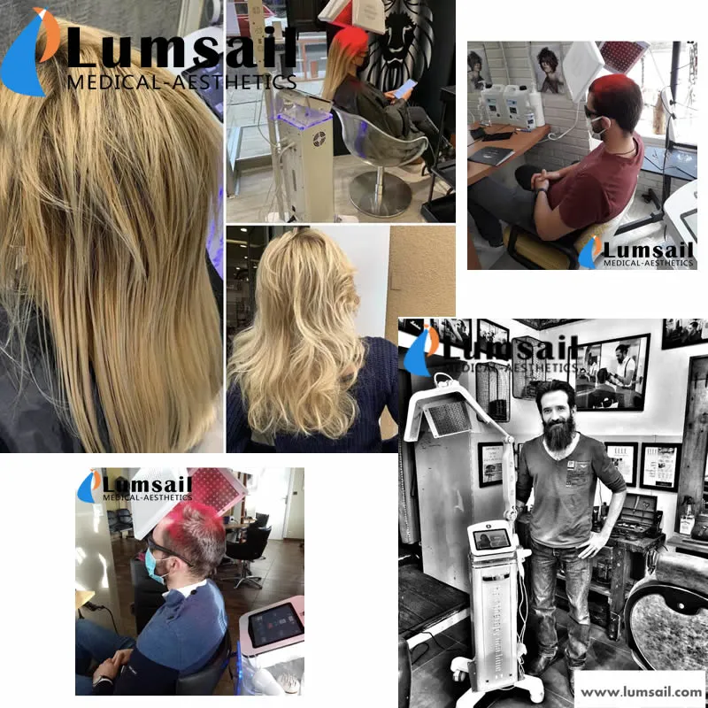 Hair Regrowth Laser Device Treatments for Hair Loss