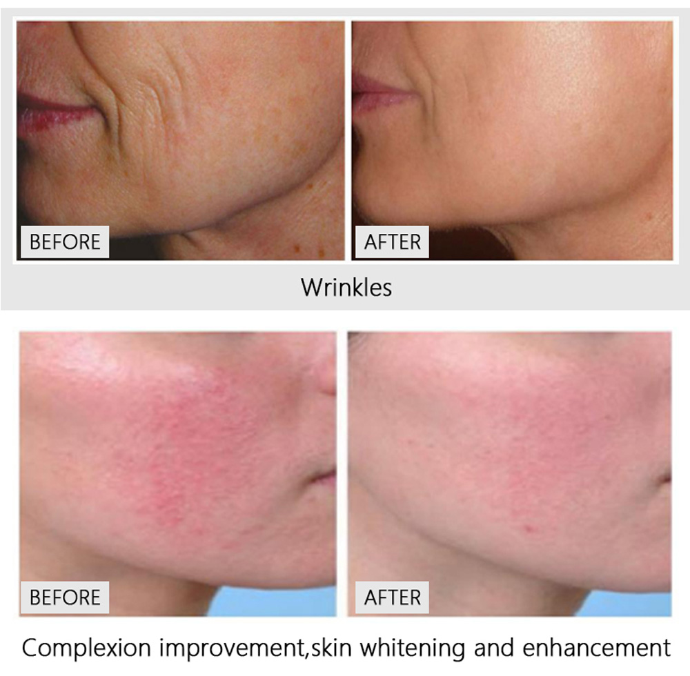 Before and After Treatment Results 2