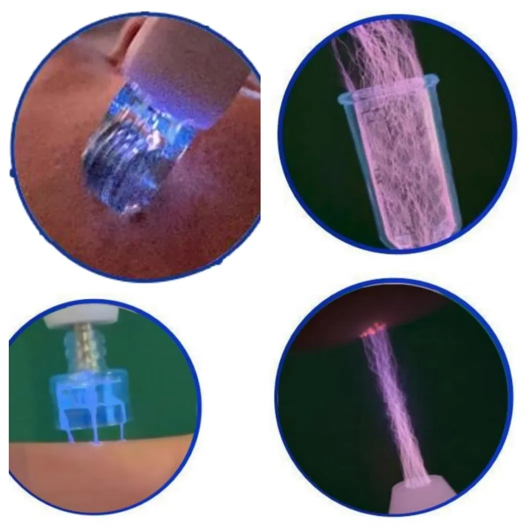 Jet Plasma Technology Anti-Aging Skin Care Collagen Regeneration Surgical Device Cold Plasma