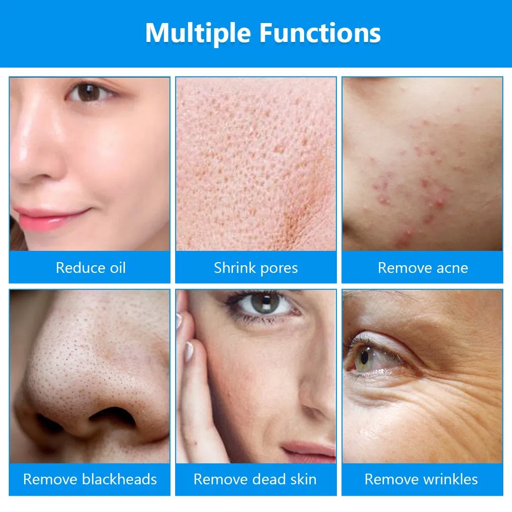 OEM/ODM Diamond Dermabrasion Oxygen Spray Vacuum Pore Cleaner Dead Skin Removal Blackhead Remover