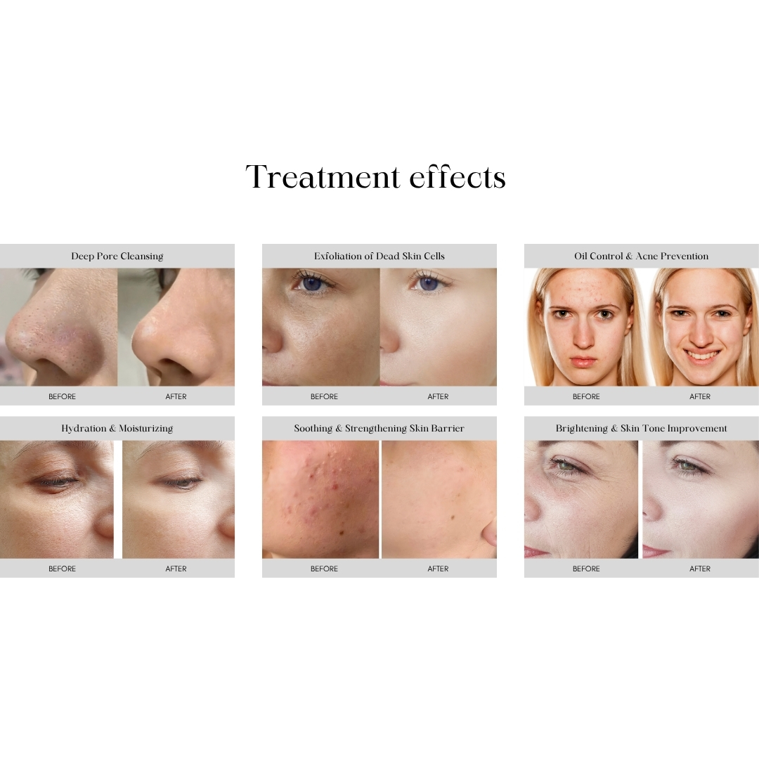 2025 Best Hydra Microdermabrasion Skin Rejuvenation Face Lifting Facial Skin Care Multifunction Hydra Machine