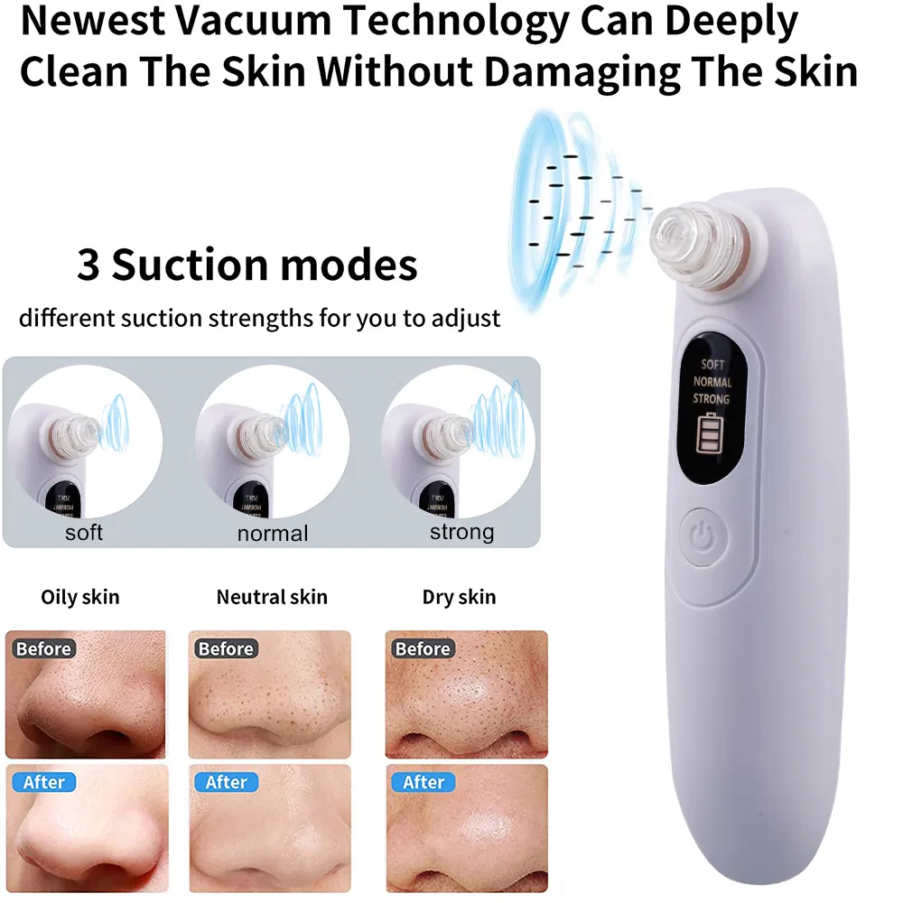 Rechargeable Vacuum Suction Blackhead Remover with LCD Display