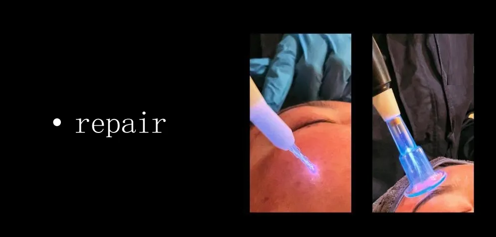Jet Plasma Technology Anti-Aging Skin Care Collagen Regeneration Surgical Device Cold Plasma