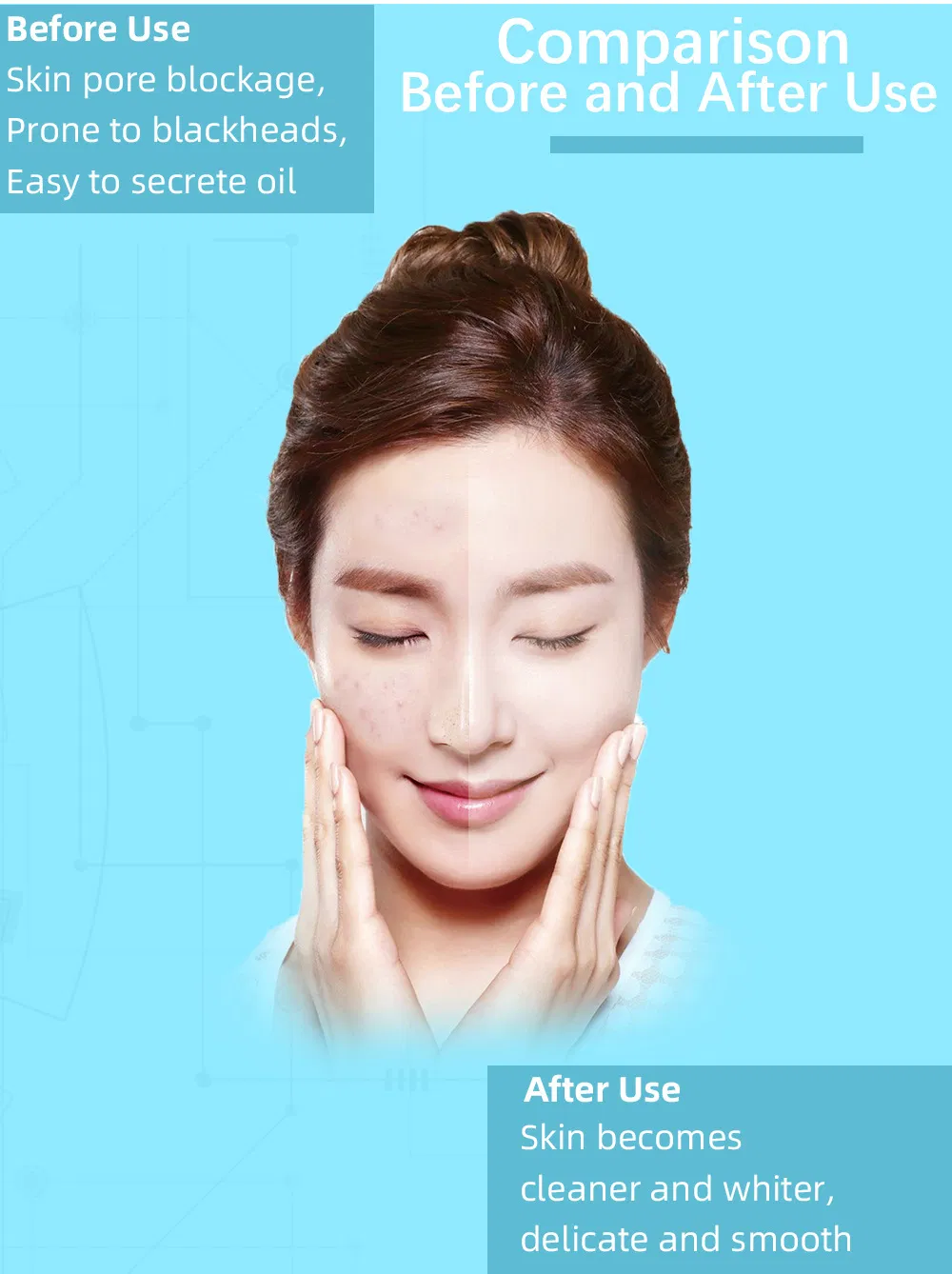 Deep Cleaning Vacuum Pore Acne Cleanser