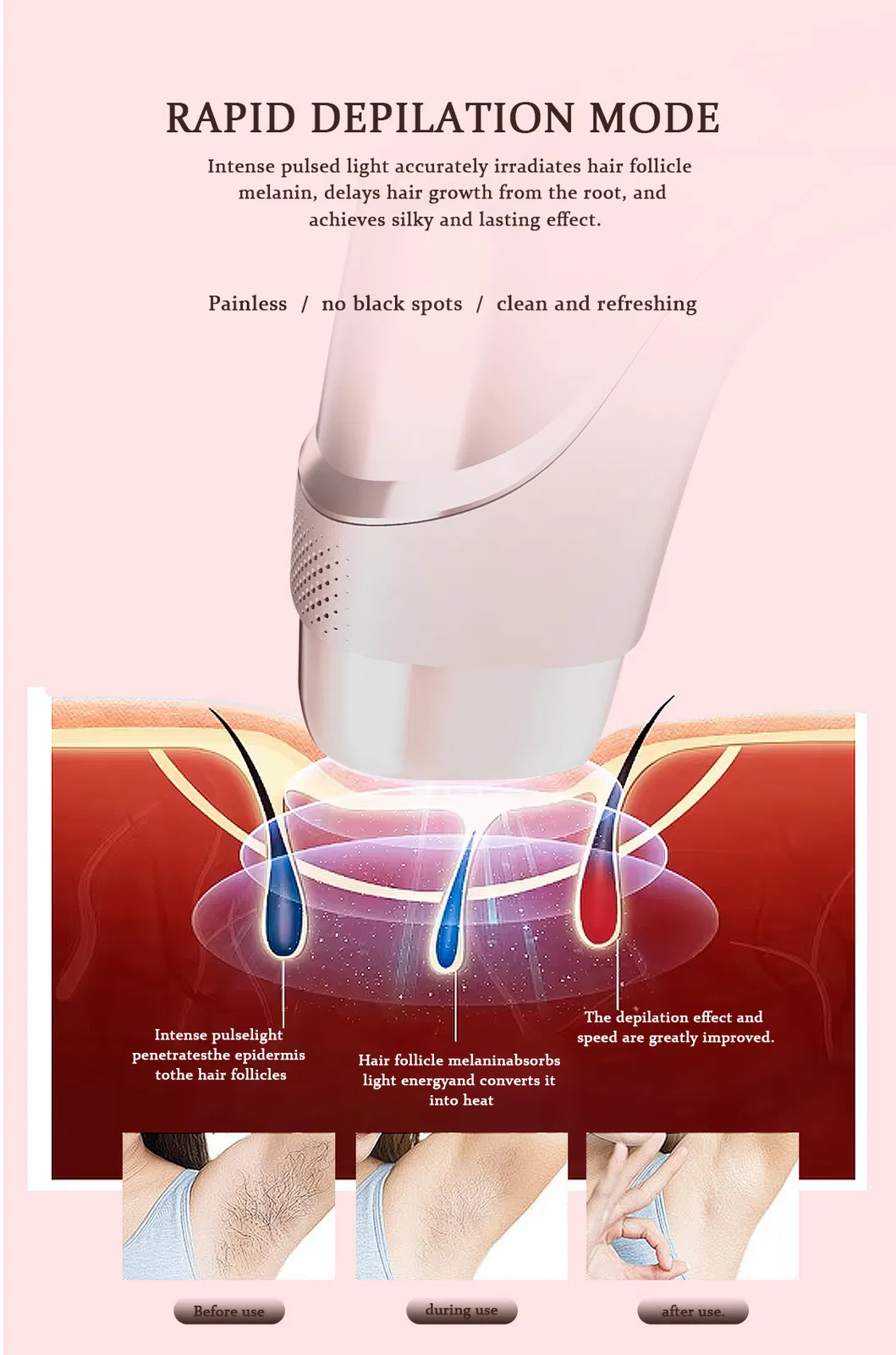 Wholesale Dropshipping 999999 Flashes Permanent Home Use IPL Laser Hair Removal Device