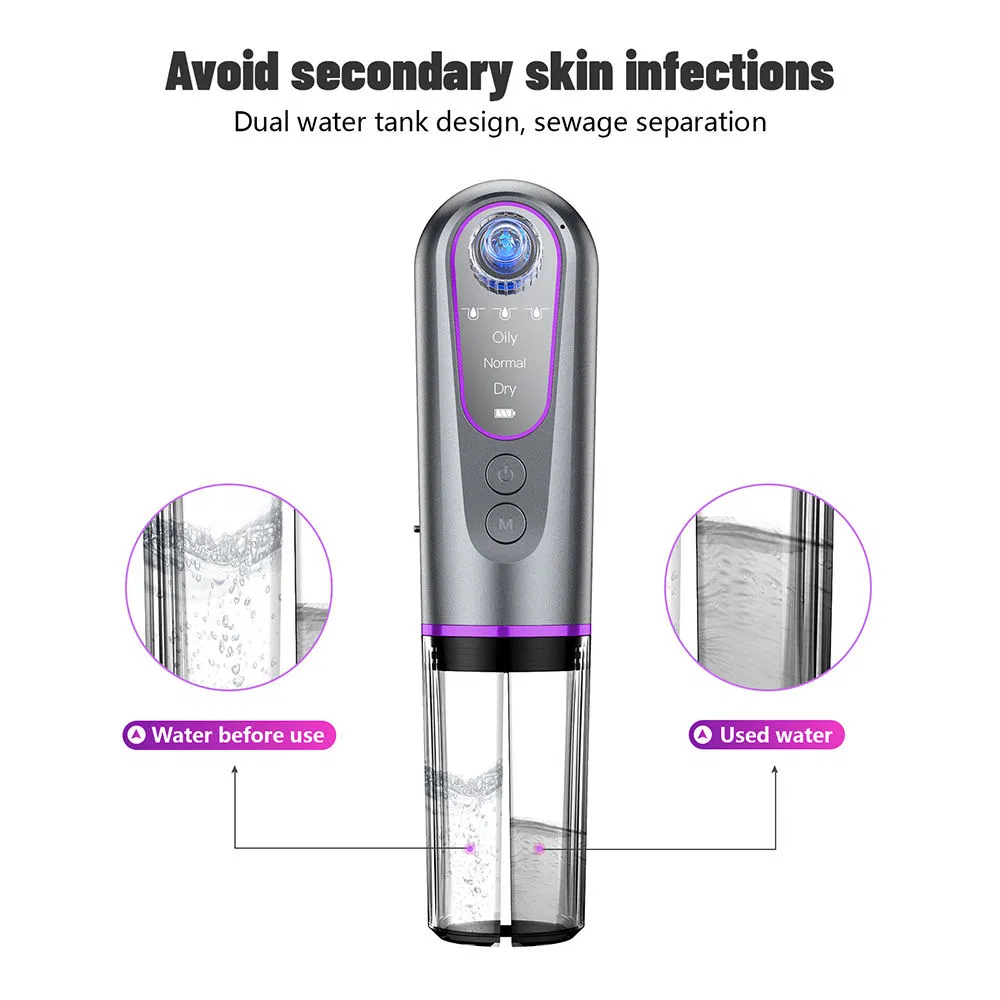 Pore Vacuum Blackhead Remover Multi-Functional Facial Smart Handheld Suction Machine Electric Vacuum