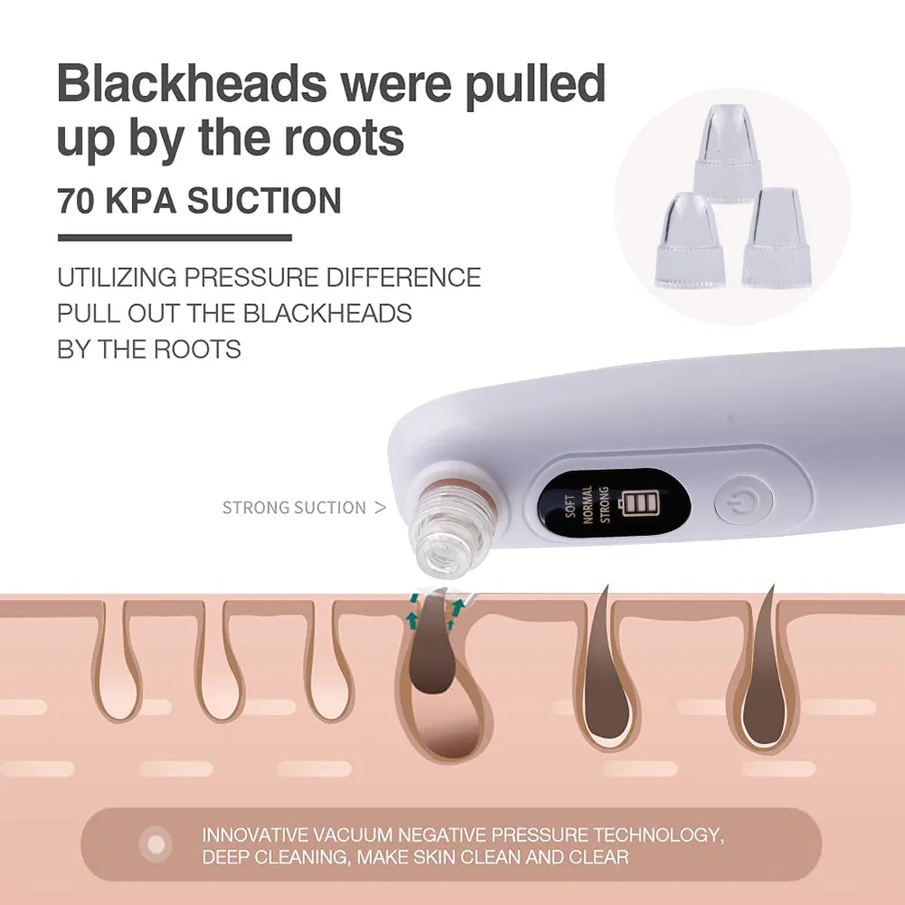 Rechargeable Vacuum Suction Blackhead Remover with LCD Display