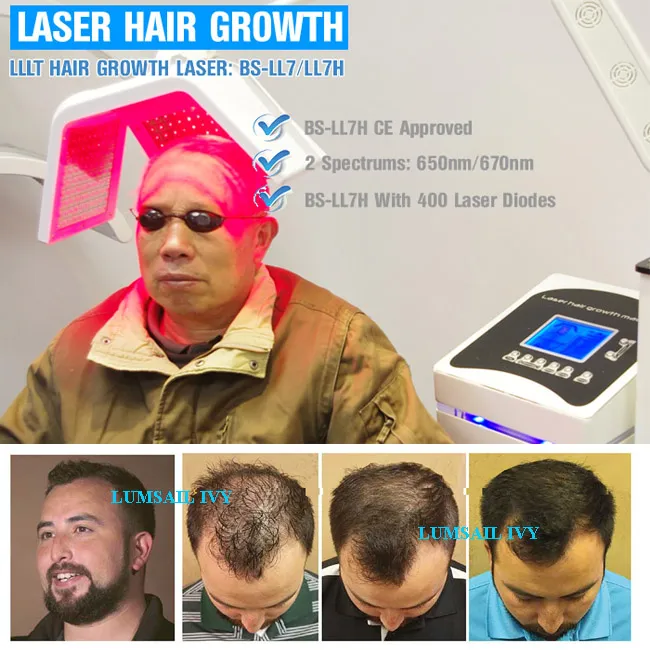Hair Regrowth Laser Device Treatments for Hair Loss