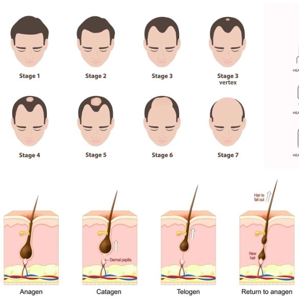 Hair Regrowth Laser Device Treatments for Hair Loss