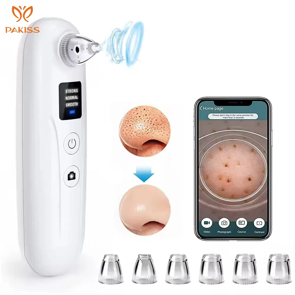 Pakiss Electric Blackhead Remover, Painless Pore Vacuum for Deep Skin Cleaning