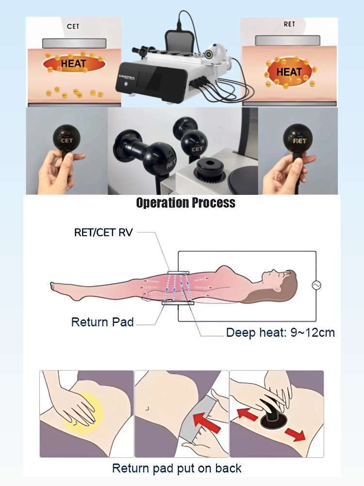 System Accessories