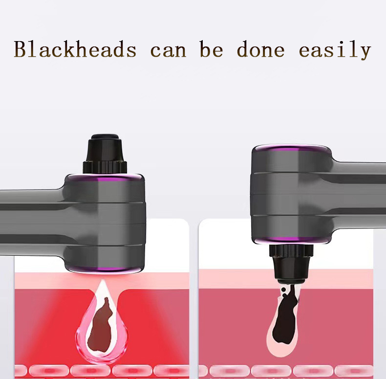 Acne Remove Tool USB Rechargeable Electric Deep Facial Pore Cleaner Vacuum Blackhead Remover
