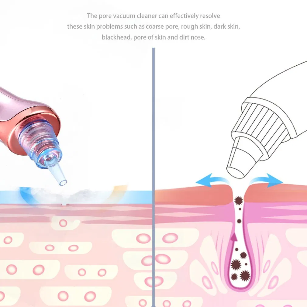 Pore Cleanser