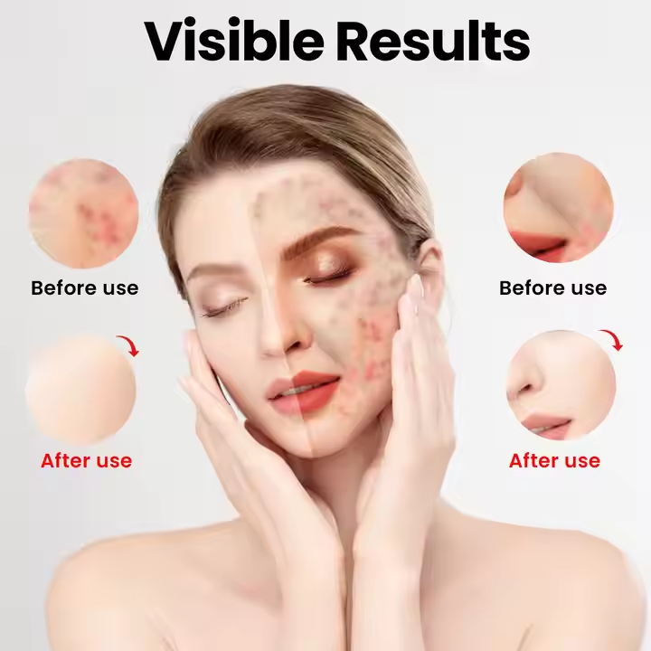 LED Light Therapy Facial Mask Red Light & Peel-Off Cream Crystal Face Mask