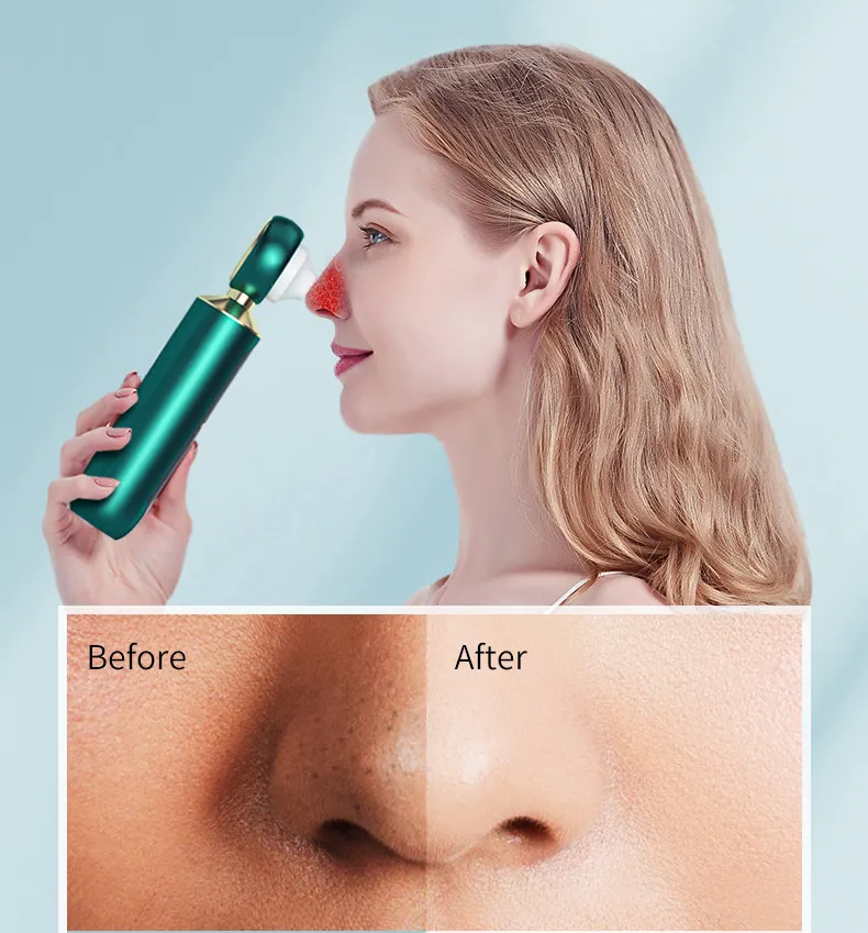 Visualized Blackhead Beauty Instrument to Remove Vacuum Electric Blackhead Remover