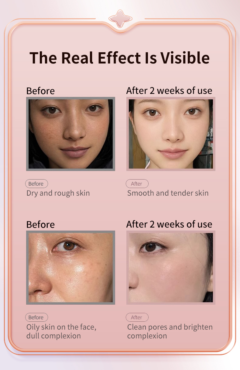 Facial steamer