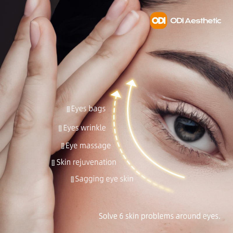 Eye Spa Machine 3 in 1 Monopolar RF+serum Introduction+Massage Eye Bag Remover Rf Skin Tightening Device