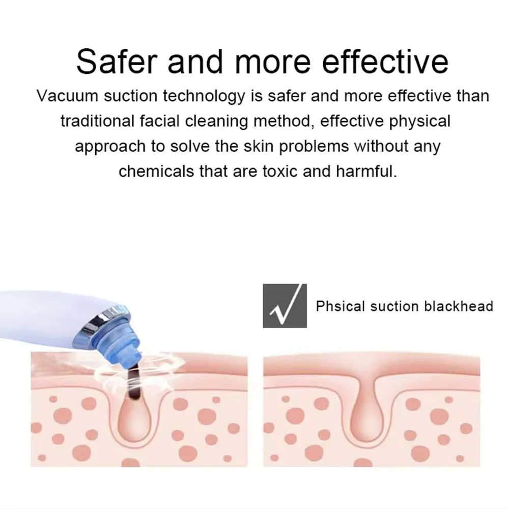 New Arrival Facial Pore Cleaner Acne Vacuum Suction Blackhead Remover
