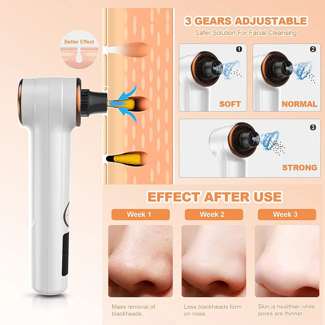 Acne Remove Tool USB Rechargeable Electric Deep Facial Pore Cleaner Vacuum Blackhead Remover
