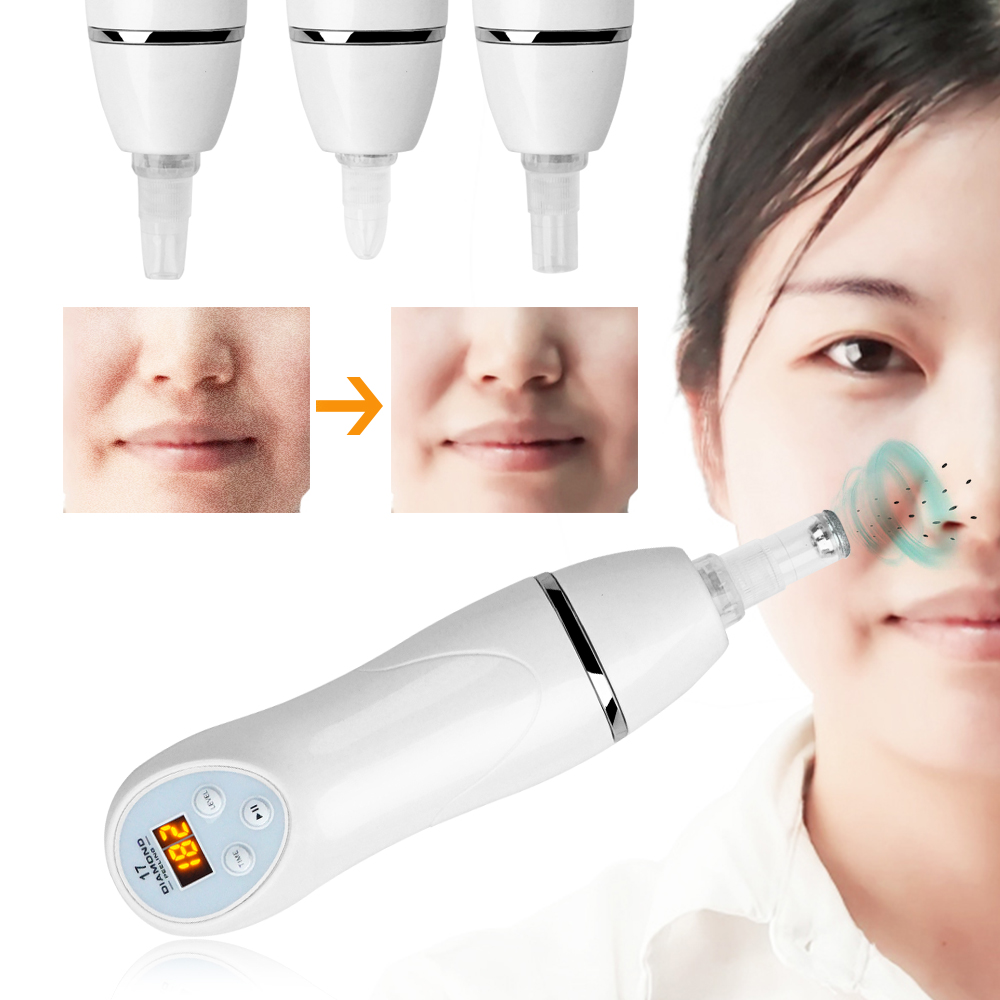 Diamond Microdermabrasion Feature Image 10
