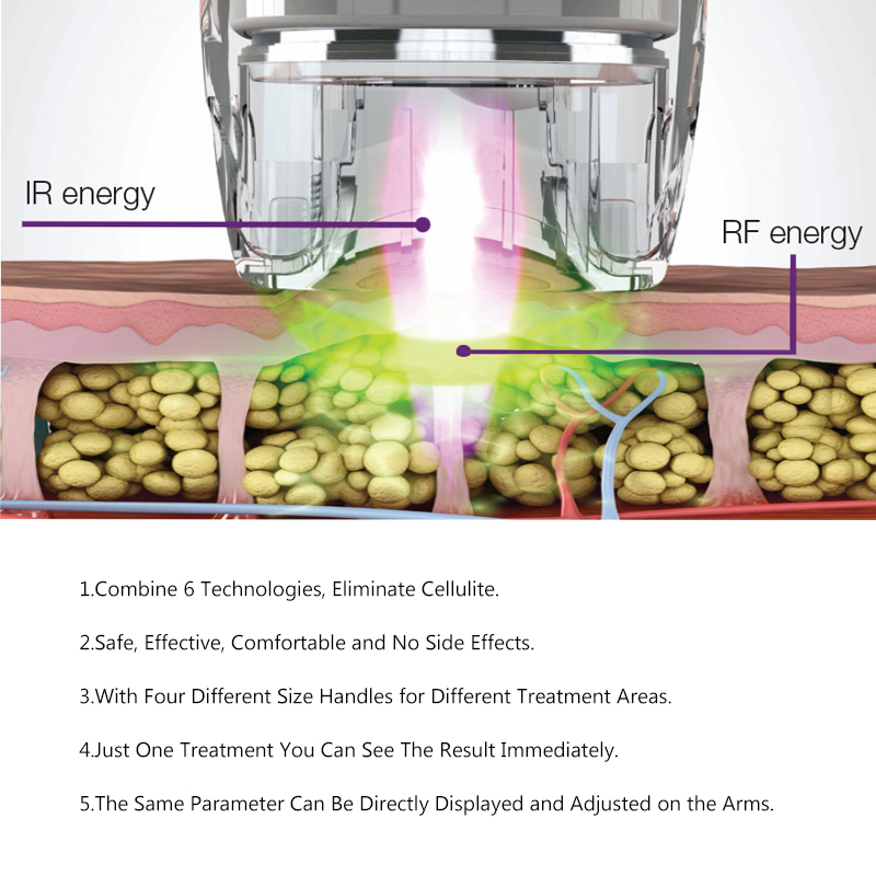 Winkonlaser CE Approved 6 In 1 Vacuum Rf Roller Massage Machine For Body Contouring And Weight Loss