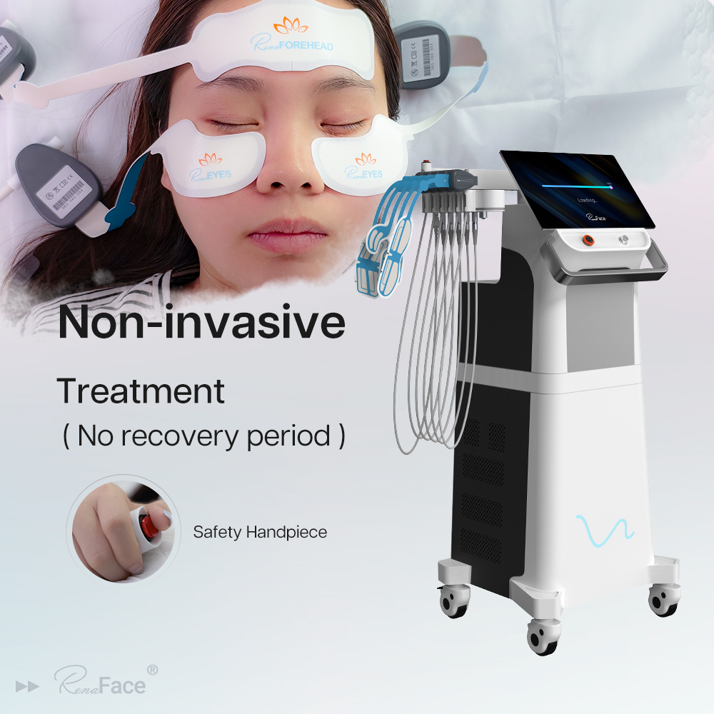 Renasculpt 3 Handle Electromagnetic RF Skin Tightening Machine