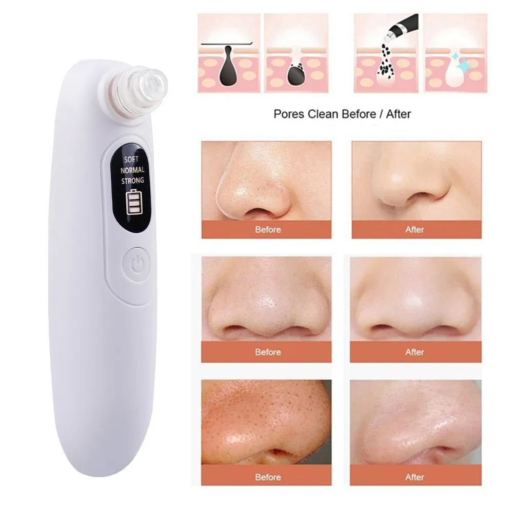 Rechargeable Vacuum Suction Blackhead Remover with LCD Display