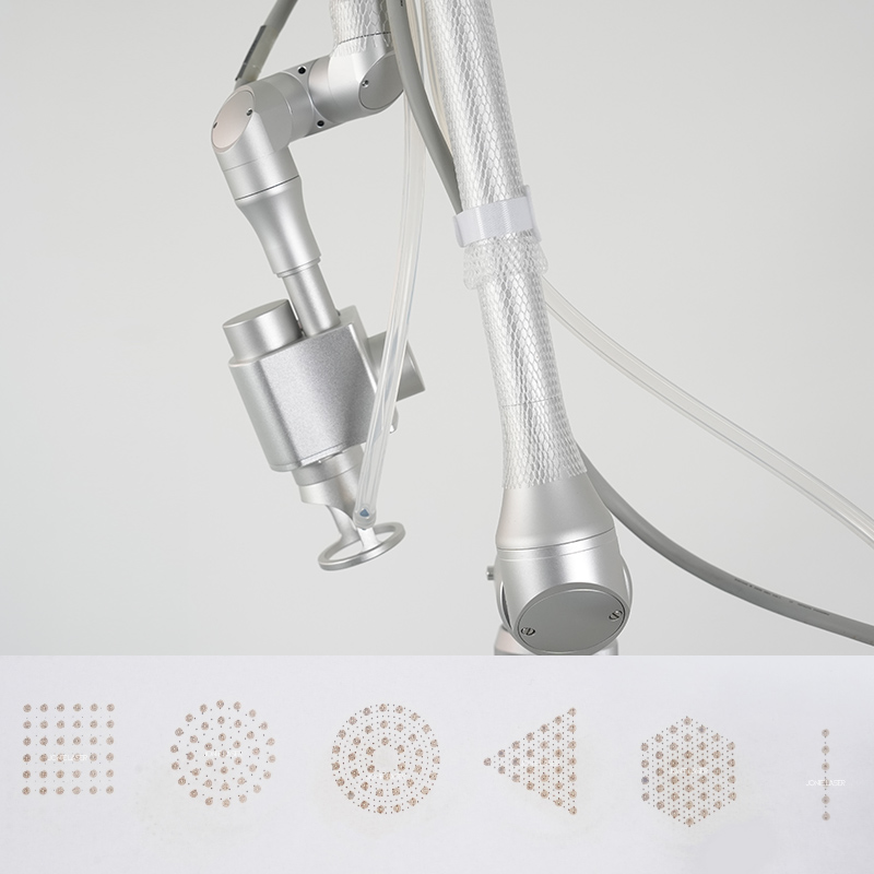 Fractional CO2 Laser RF Tube for Skin Tightening and Pigment Removal