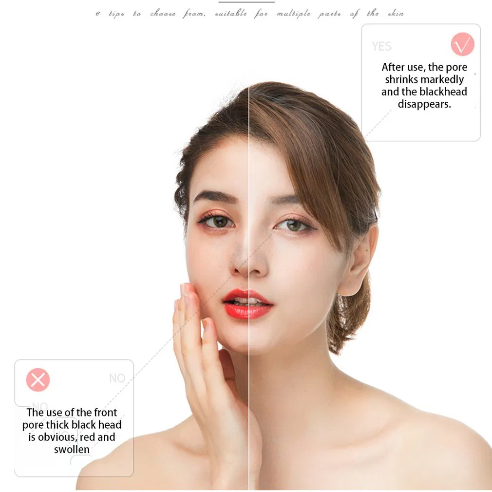 Blackhead Remover Tool