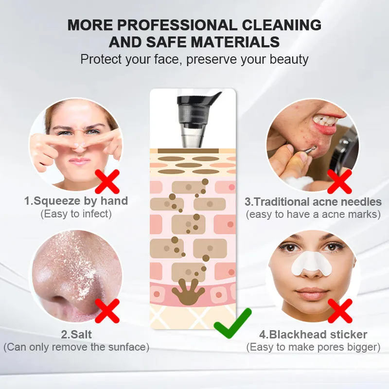 Blackhead Remover 10