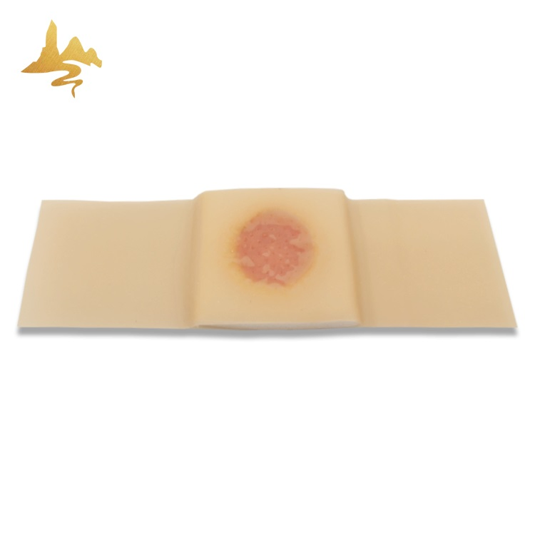 Chinese Herbal Salicylic Acid Spunlace Fabric Foot Removing Corn Removal Plaster