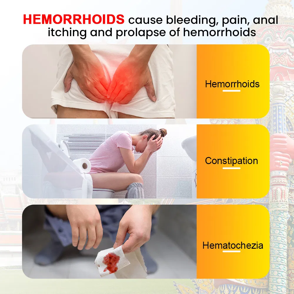 Chinese Herbal Hemorrhoids Cream Ointment