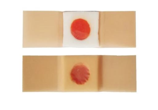 Chinese Traditional Herbal Medical Treatment Foot Corn Plaster