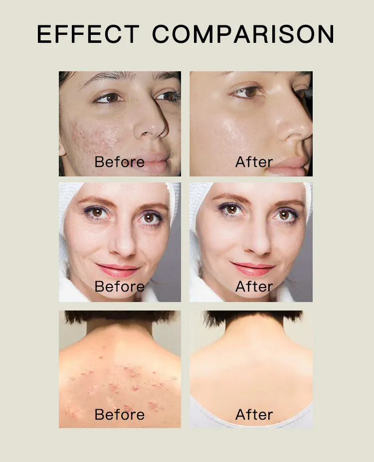 Turmeric Bath Soap 3