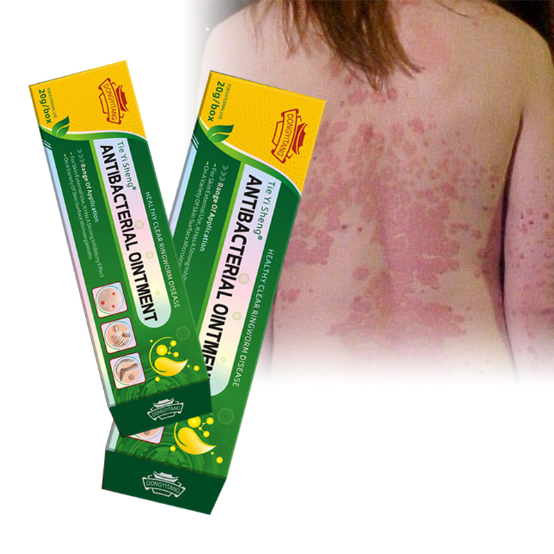 Herbal Ointment for Eliminating Allergies and Anti-Inflammatory Effects