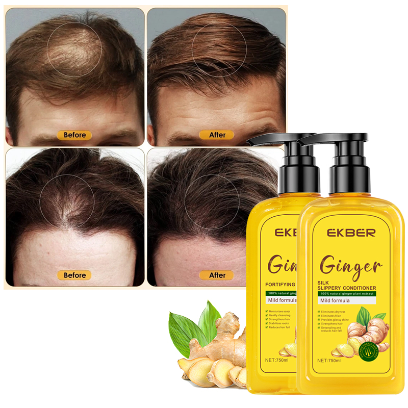 OEM and ODM Ginger Hair Treatment Kit for Healthy Hair