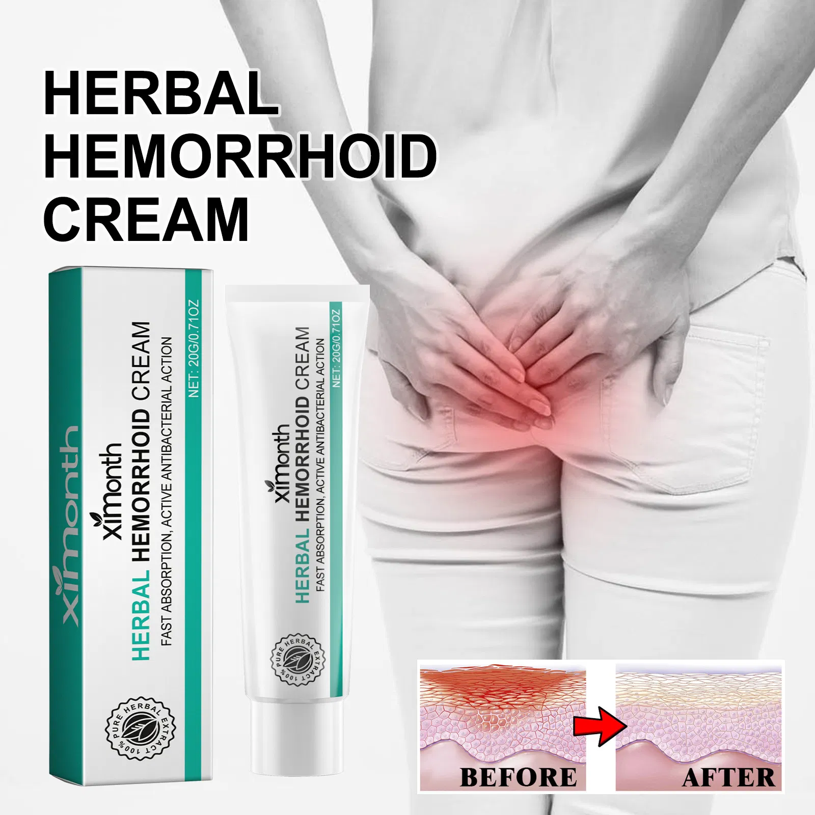 Hemorrhoid Ointment Hemorrhoids Care Cream Internal Piles Anal Anus Herbal